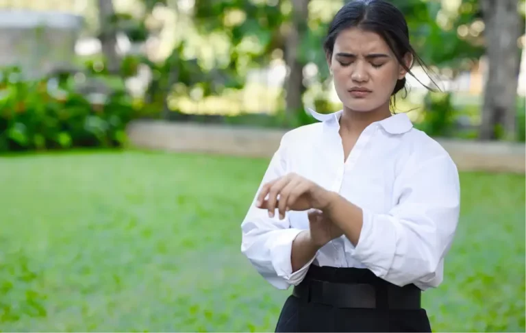 young woman scratching from mosquito bites